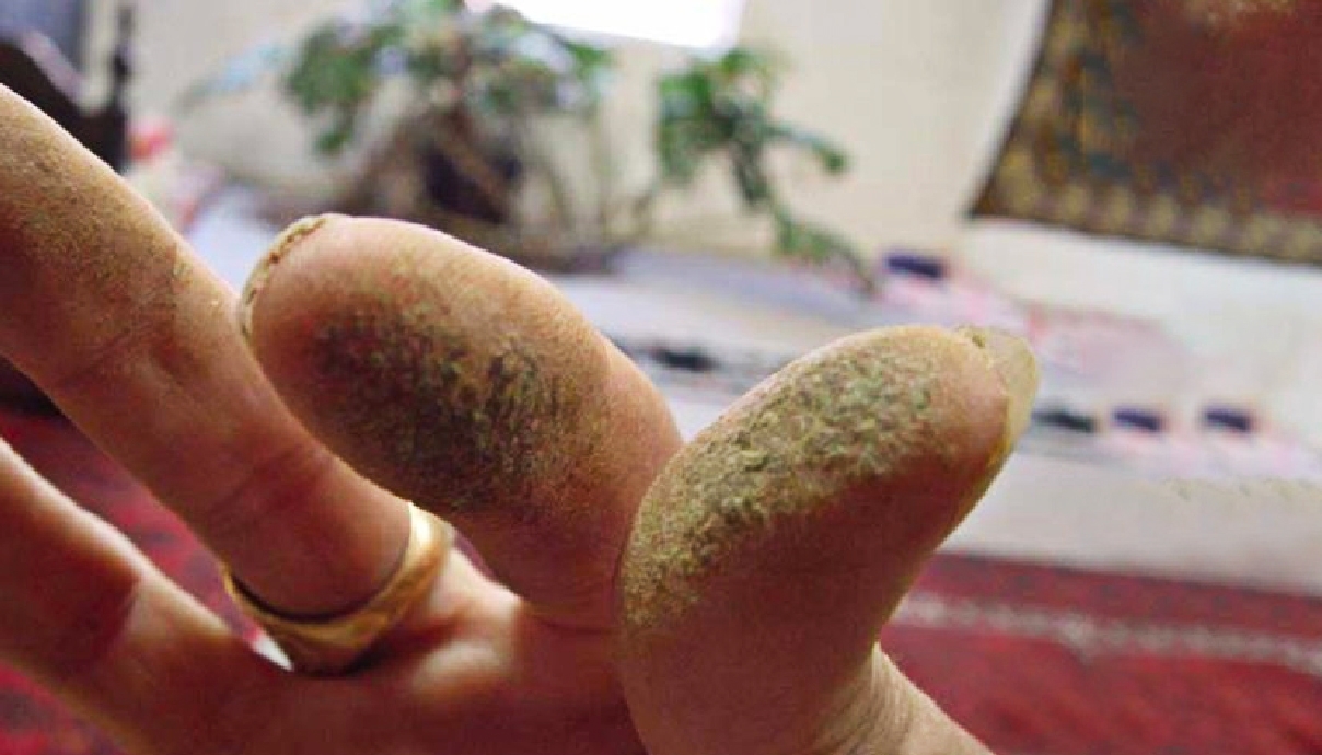 Zbyt Suche Pąki Marihuany